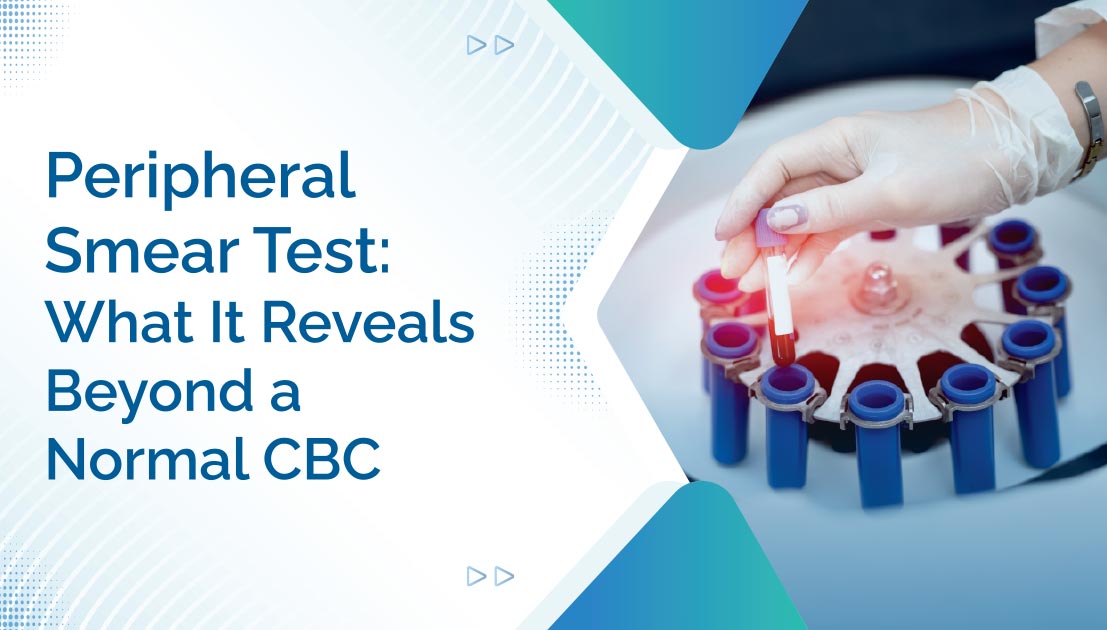 Peripheral Smear Test: What It Reveals Beyond a Normal CBC