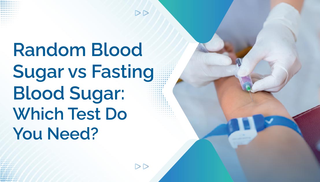 Random Blood Sugar vs Fasting Blood Sugar: Which Test Do You Need?