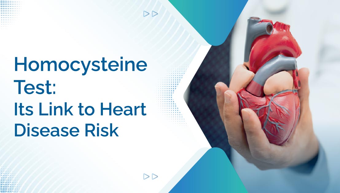 Homocysteine Test: Its Link to Heart Disease Risk
