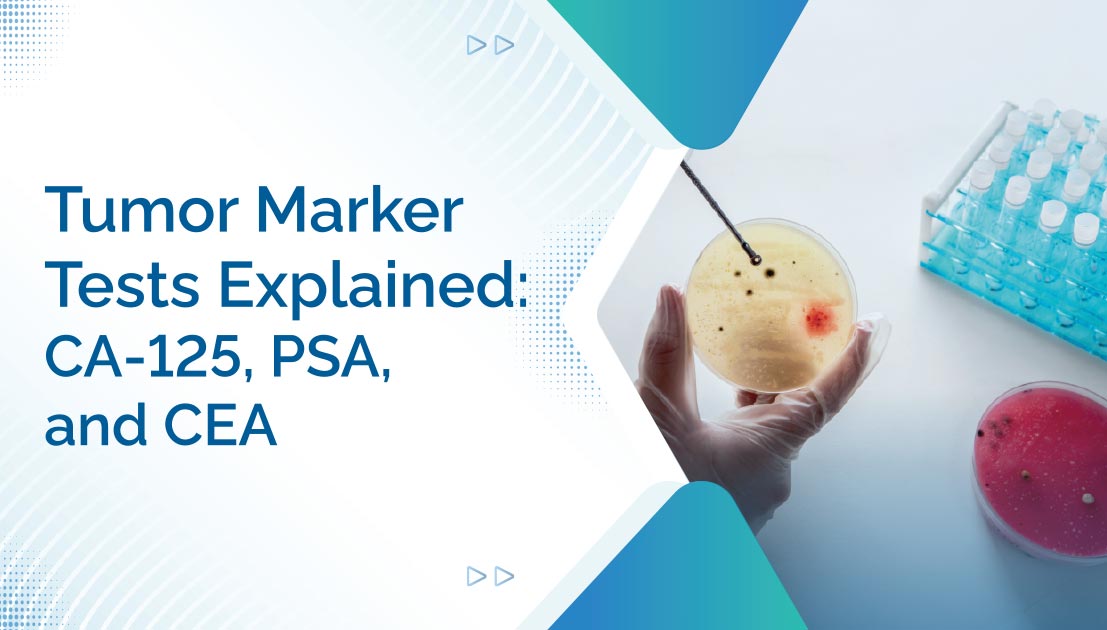 Tumor Marker Tests Explained: CA-125, PSA, and CEA