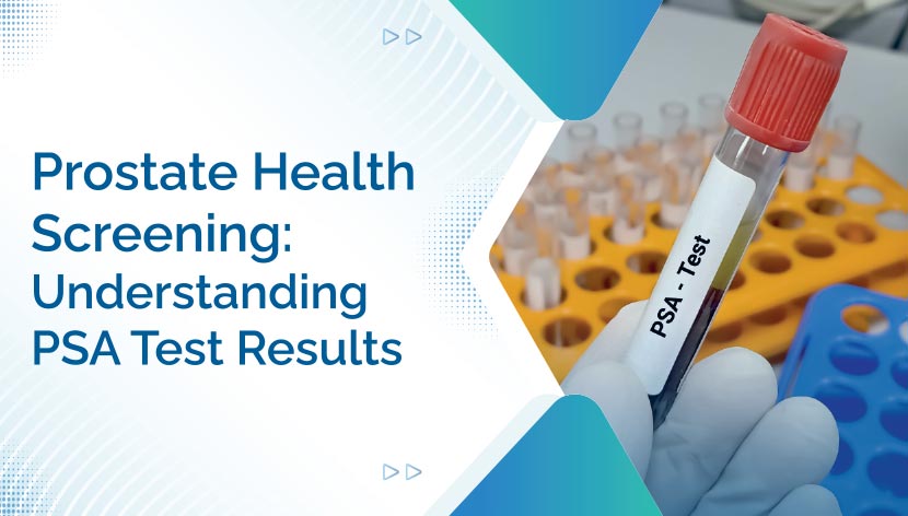 Prostate Health Screening: Understanding PSA Test Results