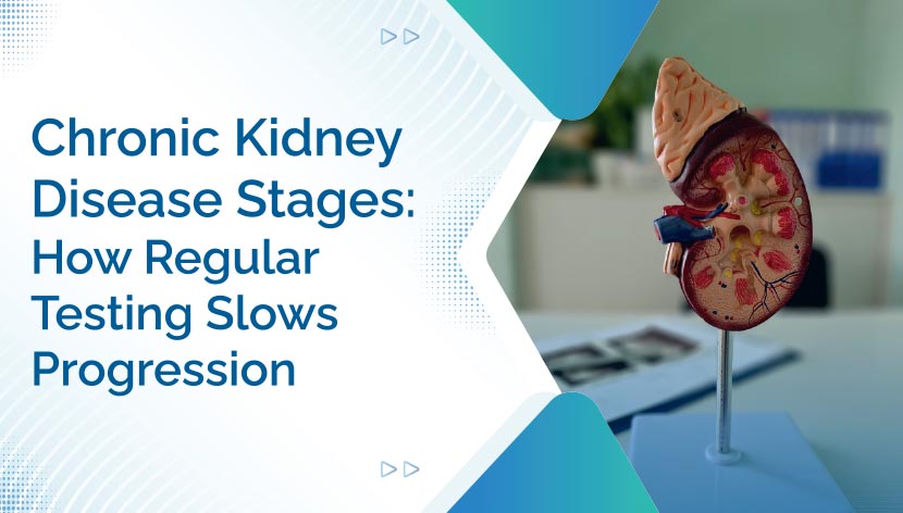 Chronic Kidney Disease Stages: How Regular Testing Slows Progression