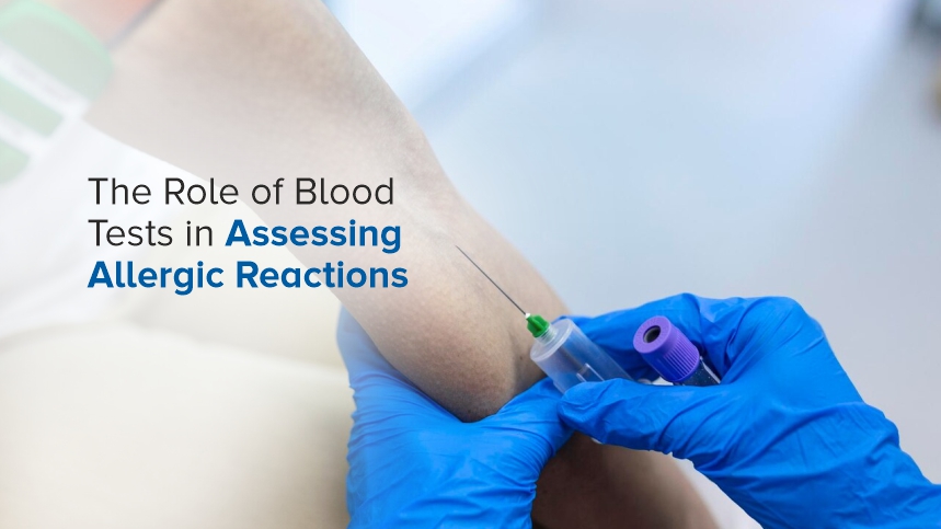 The Role of Blood Tests in assessing Allergic Reactions
