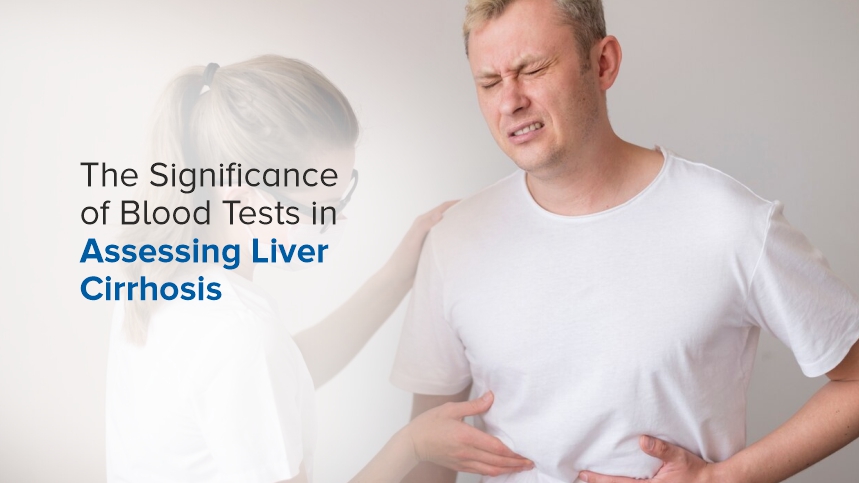 The Indispensable Importance of Blood Tests in Diagnosing and Monitoring Liver Cirrhosis Patients