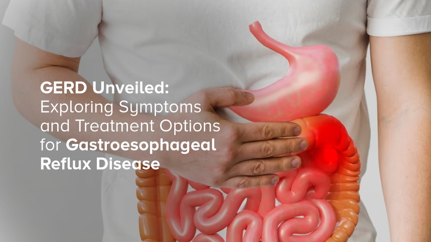 Unmasking GERD: A Deep Dive into Gastroesophageal Reflux Disease