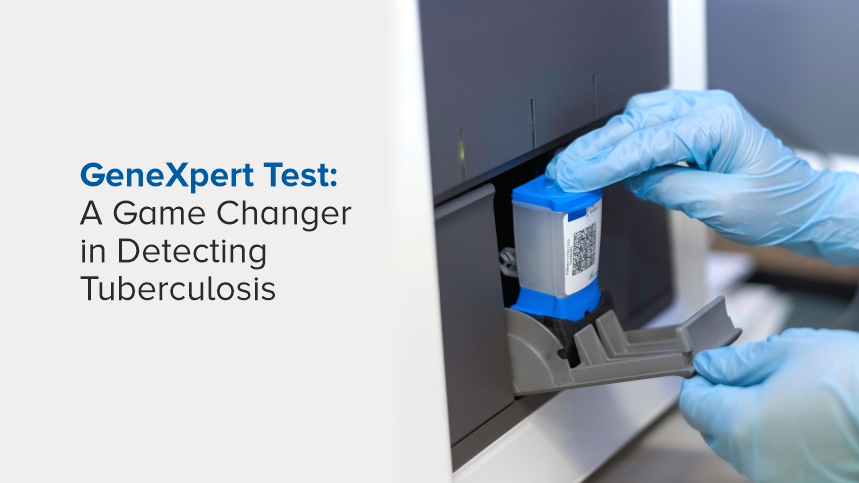GeneXpert Test: Revolutionizing Tuberculosis Detection