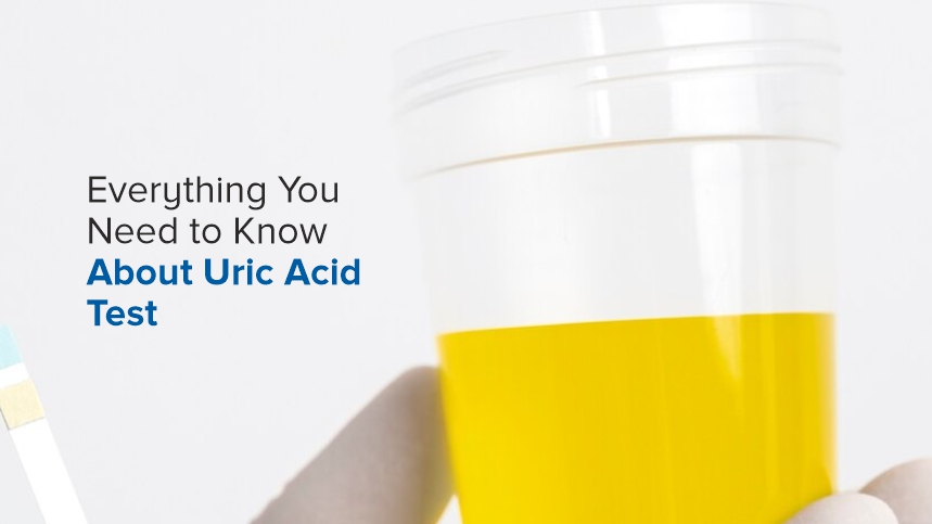Everything You Need to Know About the Uric Acid Test