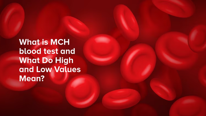 Understanding the MCH Blood Test: High and Low Values Decoded