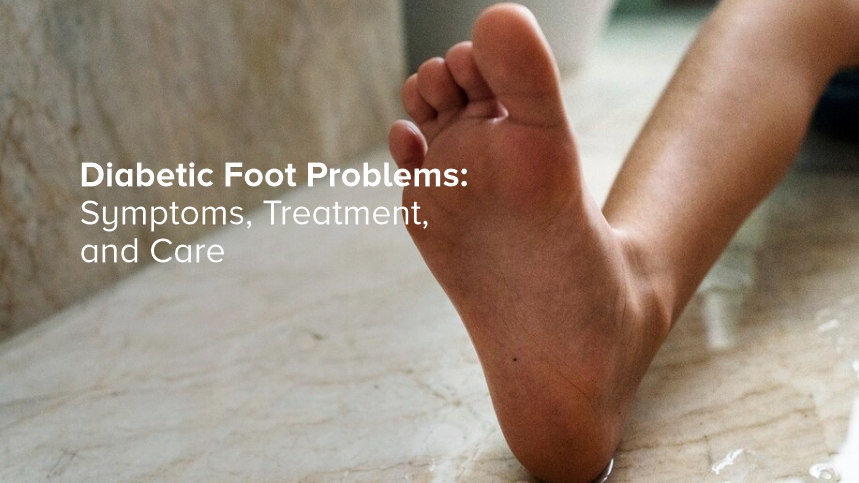 Diabetic Foot Problems: Symptoms, Treatment, and Care