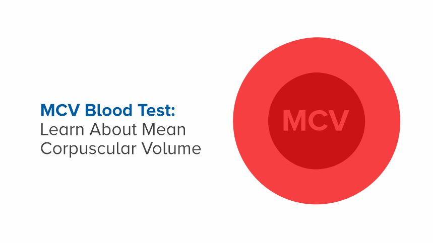 Understanding MCV Blood Tests to Monitor Your Health