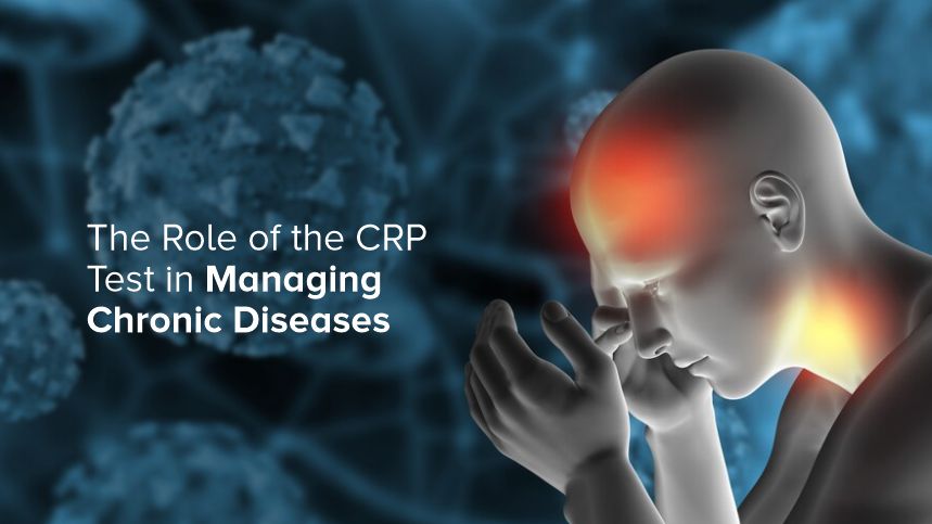 Beyond the Numbers Discovering the Hidden Power of the CRP Test in Chronic Disease Management
