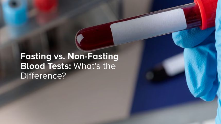 Fasting vs. Non-Fasting Blood Tests: What’s the Difference?