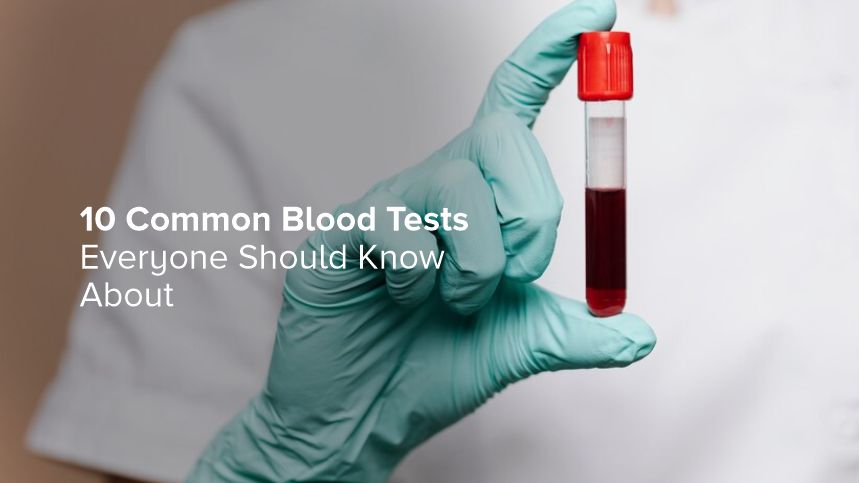 10 Common Blood Tests Everyone Should Know About