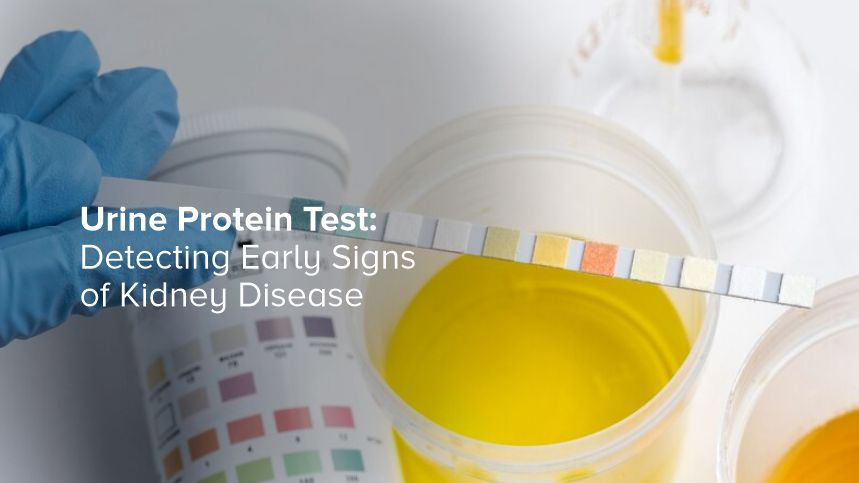 Urine Protein Test: Detecting Early Signs of Kidney Disease