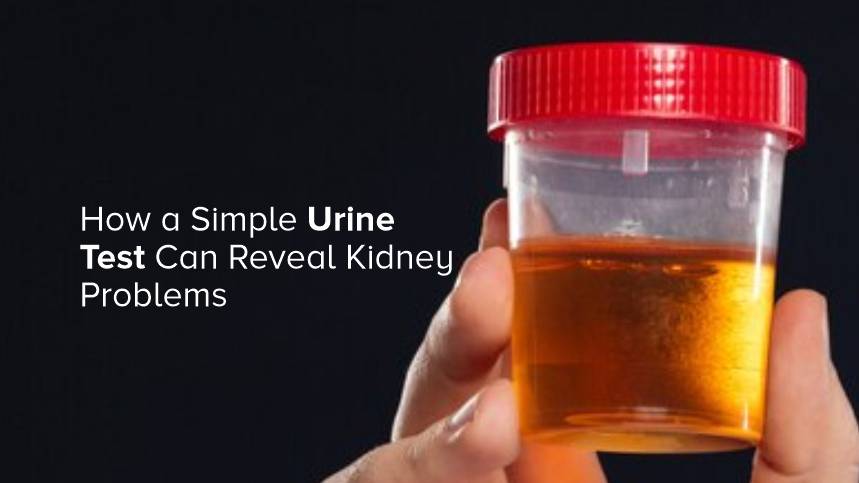 How a Simple Urine Test Can Reveal Kidney Problems