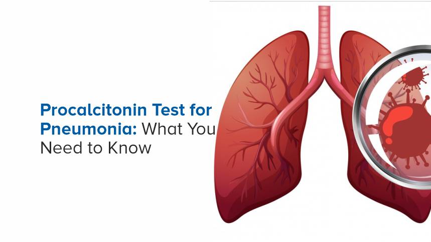 Procalcitonin Test for Pneumonia: What You Need to Know
