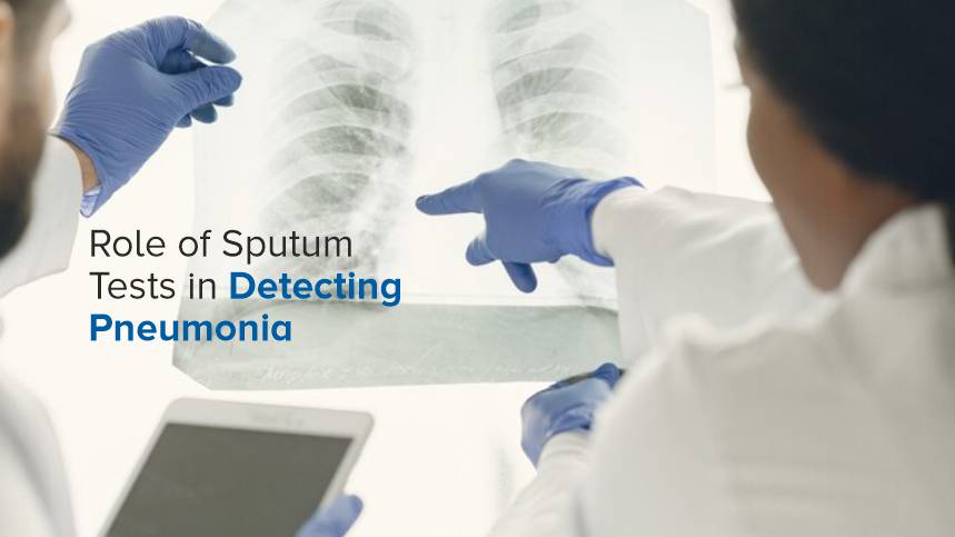 The Role of Sputum Tests in Detecting Pneumonia
