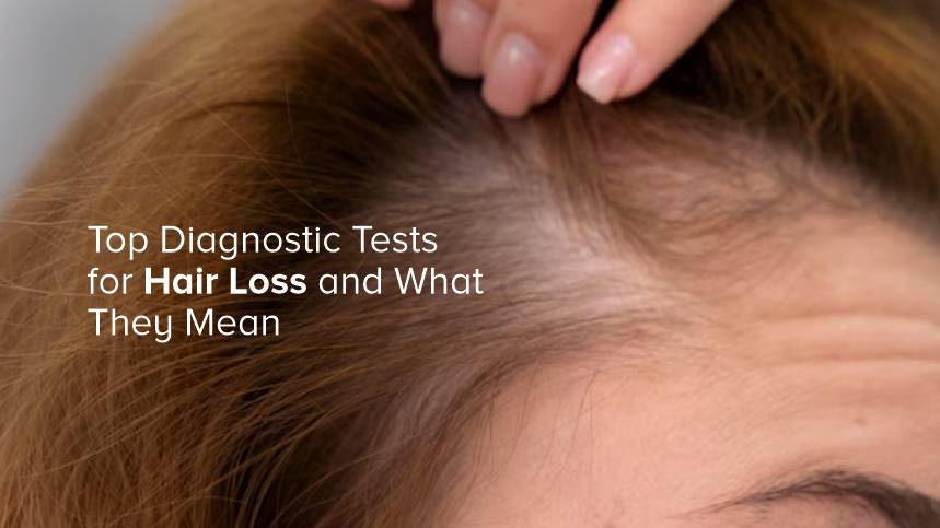 Top Diagnostic Tests for Hair Loss and What They Mean