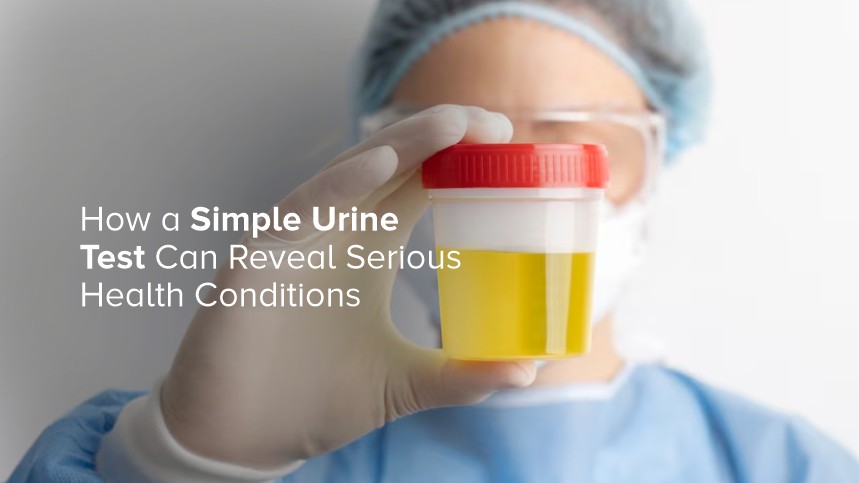 How a Simple Urine Test Can Reveal Serious Health Conditions