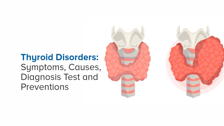 Thyroid Disorders: Symptoms, Causes, Diagnosis, and Prevention