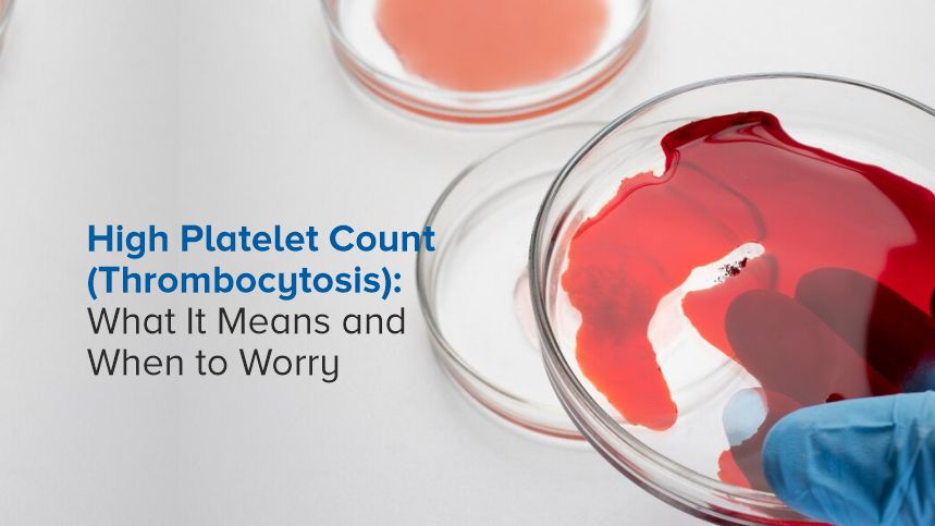 High Platelet Count (Thrombocytosis): What It Means and When to Worry