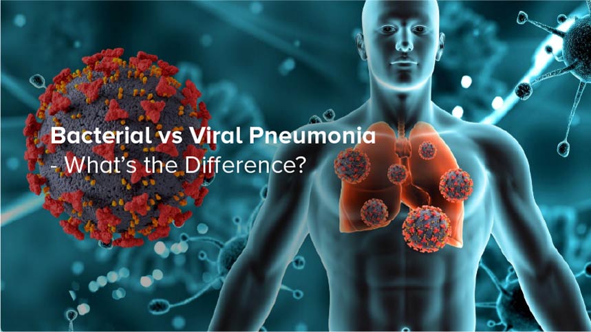 Bacterial vs Viral Pneumonia – What’s the Difference?