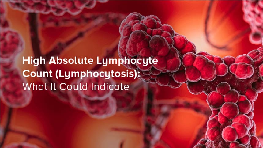High Absolute Lymphocyte Count (Lymphocytosis): What It Could Indicate