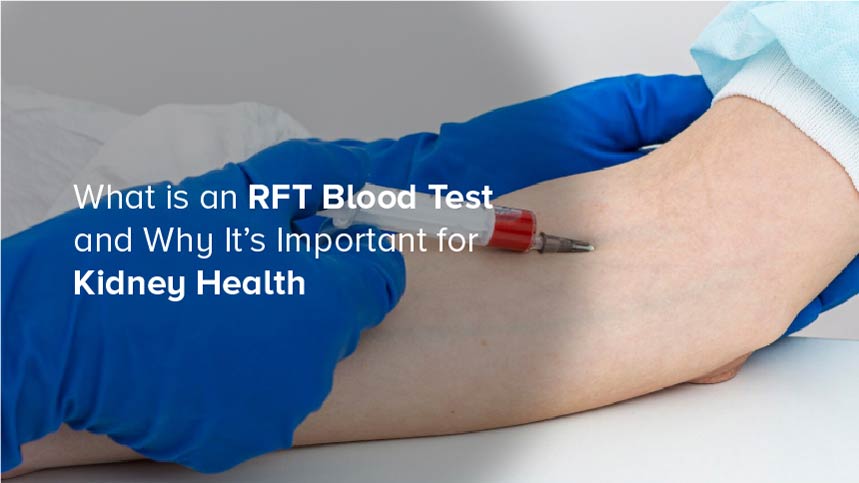 What is an RFT Blood Test and Why It’s Important for Kidney Health