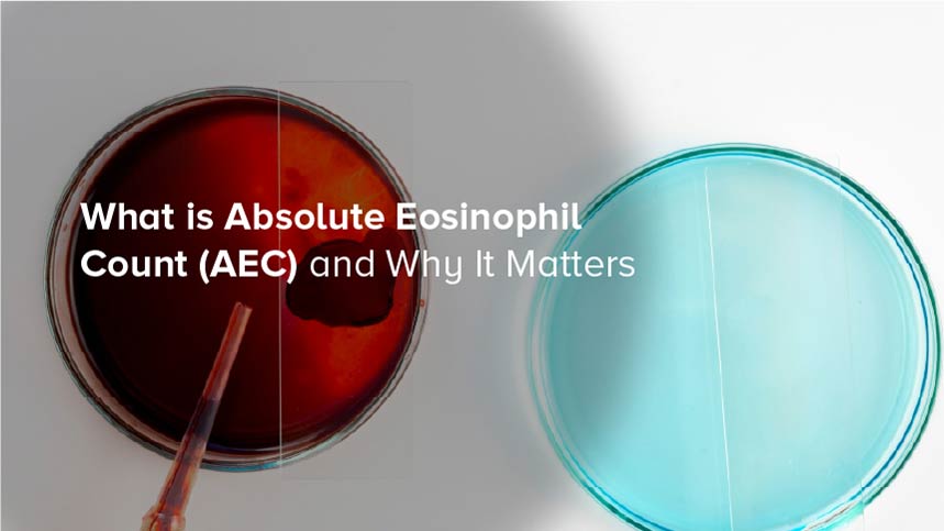 What is Absolute Eosinophil Count (AEC)?