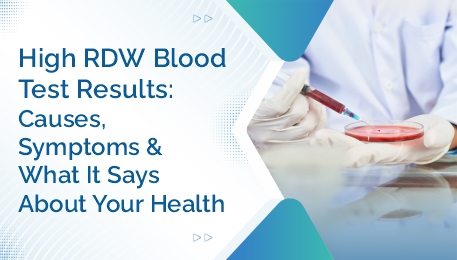 High RDW Blood Test Results Causes, Symptoms & What It Says About Your Health