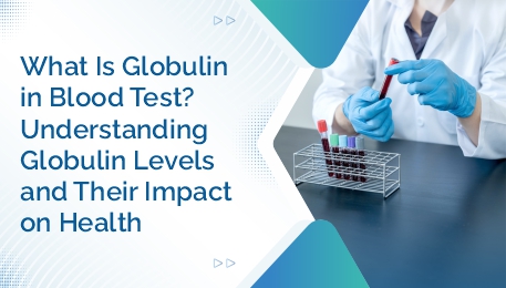 What Is Globulin in a Blood Test Understanding Globulin Levels and Their Impact on Health