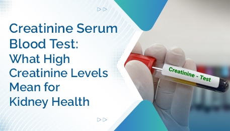 Creatinine Serum Blood Test What High Creatinine Levels Mean for Kidney Health