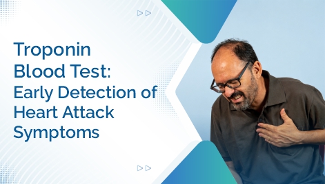 Troponin Blood Test Early Detection of Heart Attack Symptoms