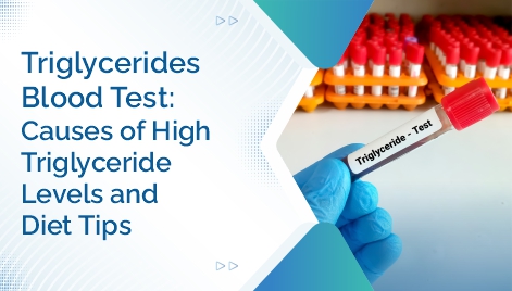 Triglycerides Blood Test Causes of High Triglyceride Levels and Diet Tips