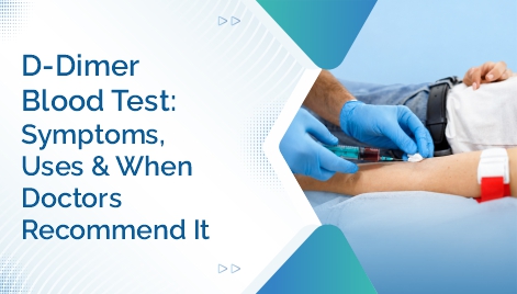 D-Dimer Blood Test Symptoms, Uses & When Doctors Recommend It