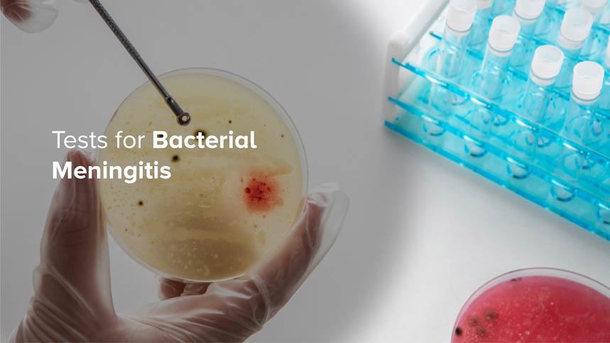 Tests for Bacterial Meningitis